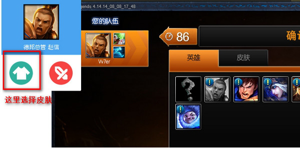 乐派英雄联盟宝盒